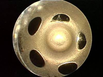 Dynomite Diesel - Cummins VE Pump 4BT Economy Series Injector Set Dynomite Diesel - Image 4